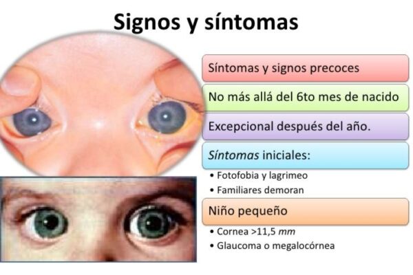 Se realizaran controles oftalmológicos gratuitos para prevenir la ceguera por Glaucoma